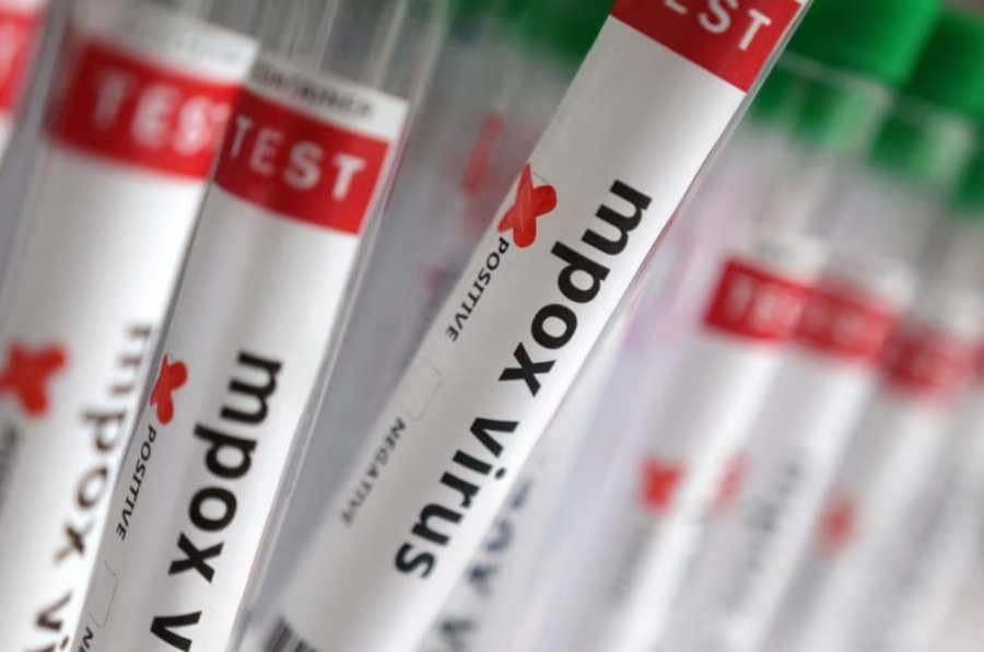 Se confirmo el primer caso de viruela de viruela del mono clado IB en Argentina 