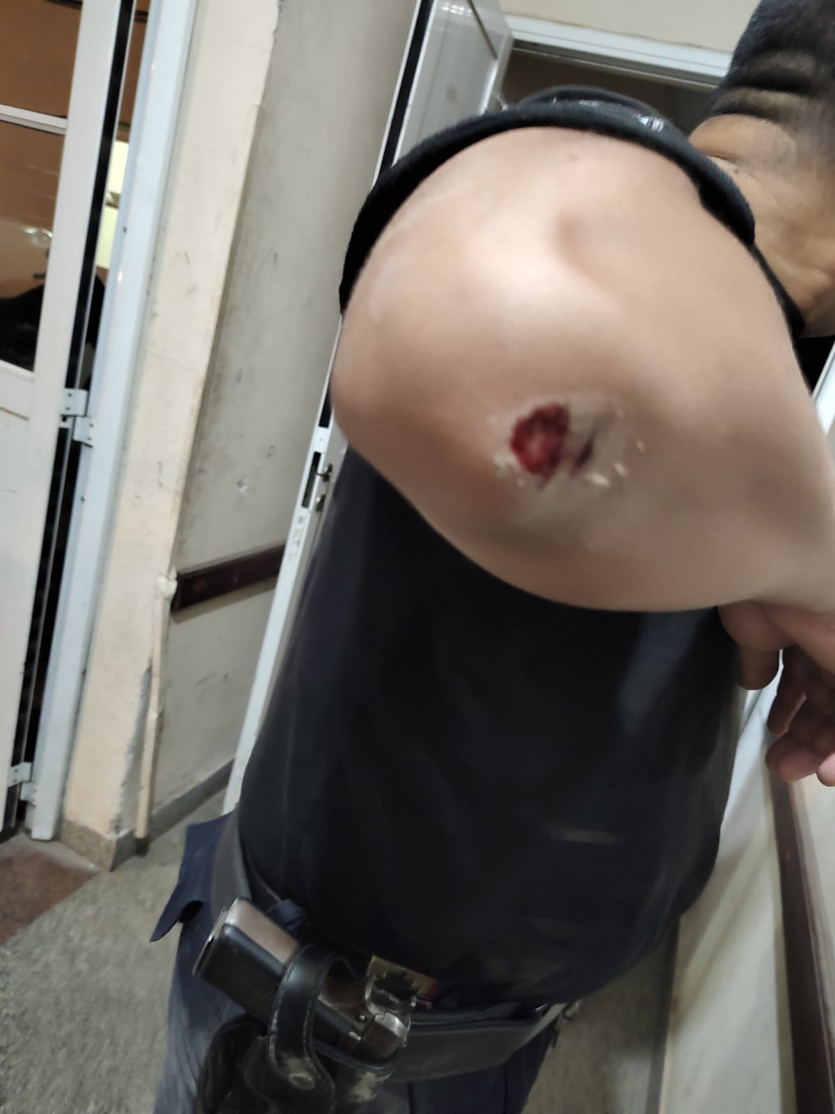 Efectivos policiales resultaron heridos al intentar a delincuentes detener 