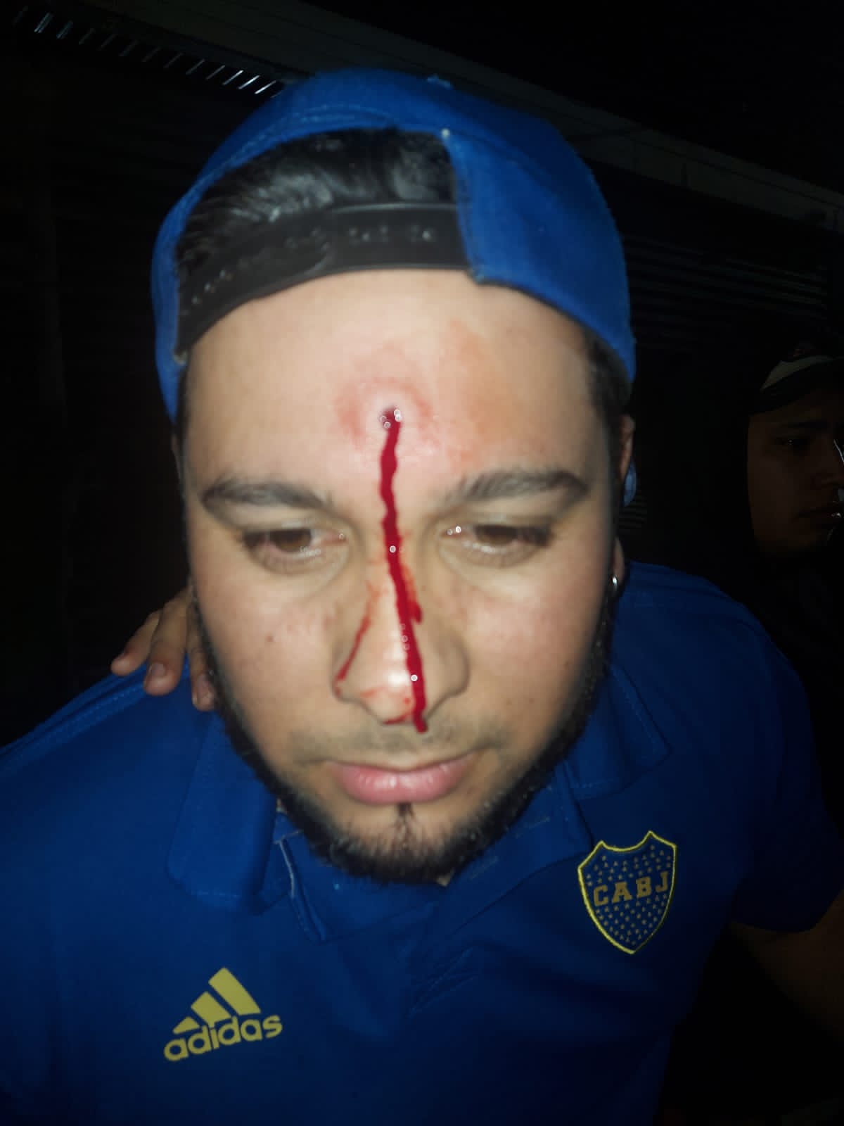 Actuaba con su banda y recibi&oacute; un disparo de aire comprimido en la cabeza 