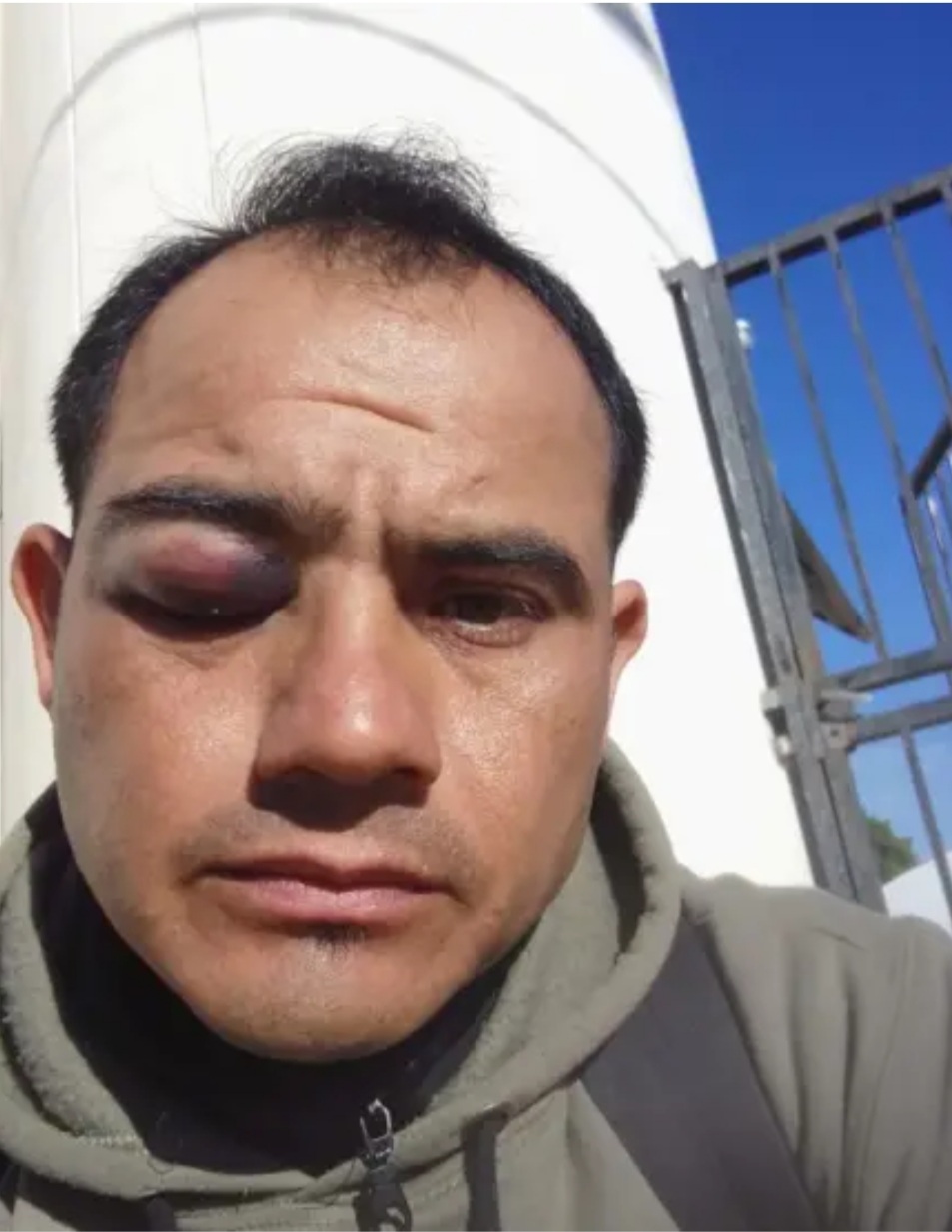 Goya : Agredieron a un &aacute;rbitro en un partido de la liga 