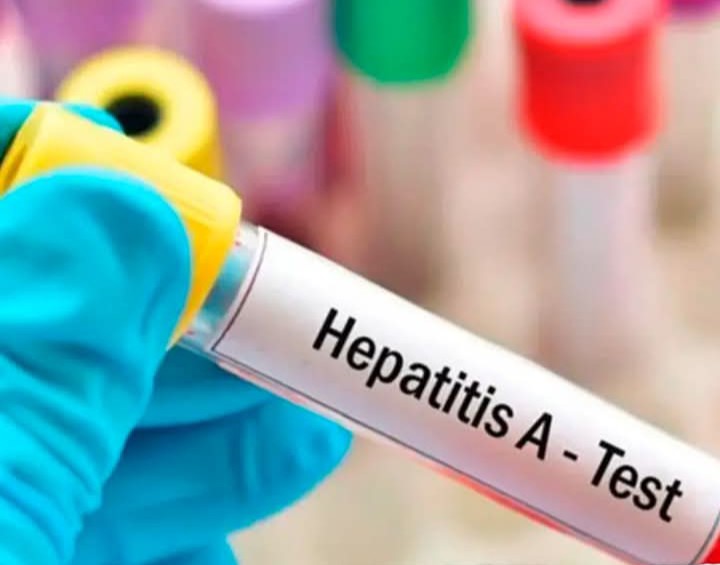 Hepatitis: Preocupa el incremento de casos en el primer semestre del año en el país