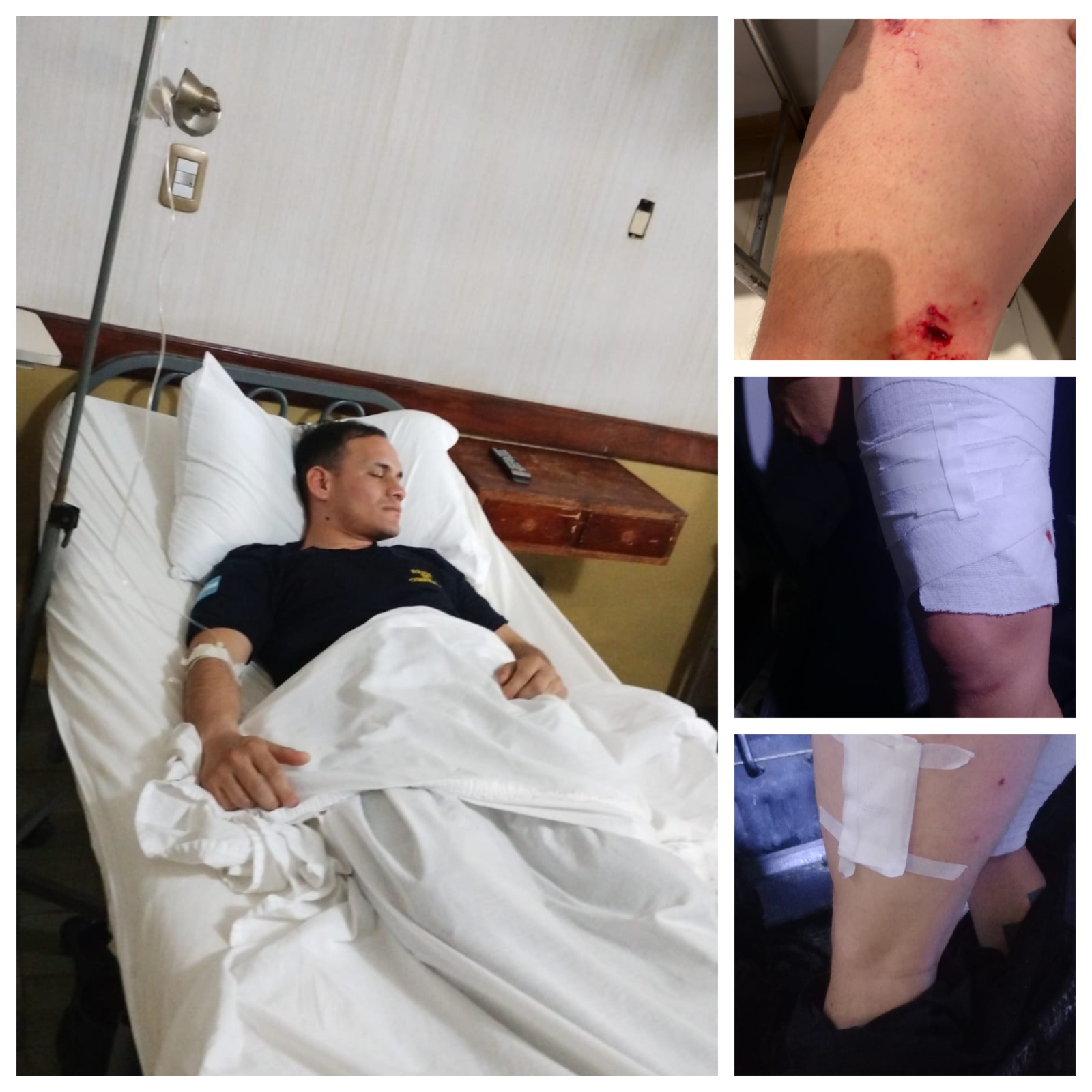 AVENIDA CARTAGENA Y CALLE G&Uuml;EMES: Tres funcionarios policiales resultaron lesionados durante un procedimiento